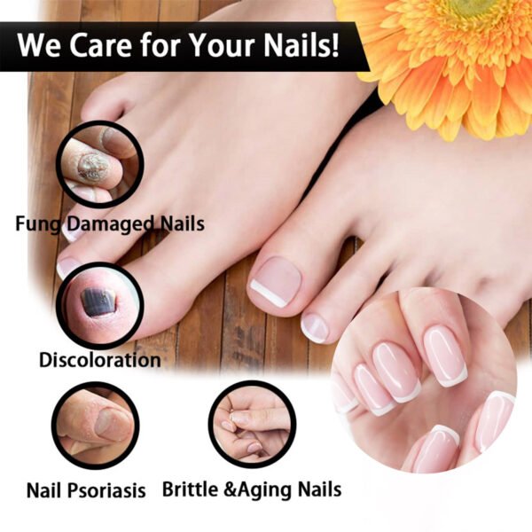 EELHOE Nail Repair Solution Thickening And Shining Nail Removal Dead Skin Repairing And Moisturizing Nail Nutritional Care Liquid - Image 5