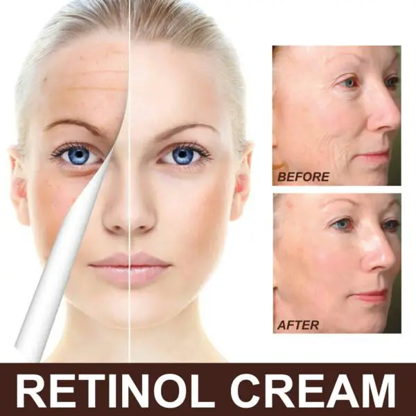 Retinol Anti Aging Wrinkle Removal Skin Firming Cream, EELHOE Retinol Cream Anti-Aging With Hyaluronic Acid And Vitamin - Image 7
