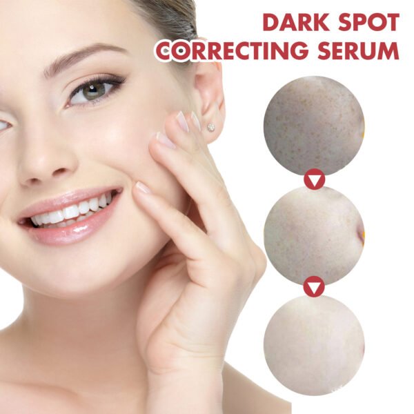 Hoygi Black Spot Repair Essence Lighten Skin Black Spot And Age Spot Moisturizing&Brightening Repair Essence - Image 3