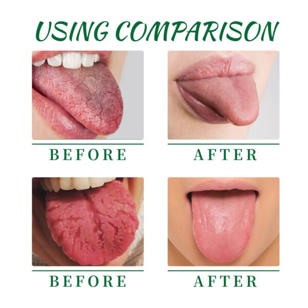 EELHOE Tongue Repair Spray Repair White Tongue Relief Dry Swollen Tongue Oral Care Spray - Image 2