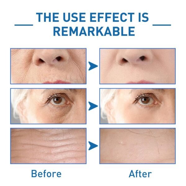 Jayswing Anti Wrinkle Firming B5 - Image 6