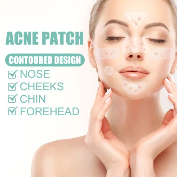 EELHOE Acne Relief Mask Patch Is A Gentle, Non-irritating Acne Mask That Helps To Reduce Acne Marks And Heal Acne. - Image 5