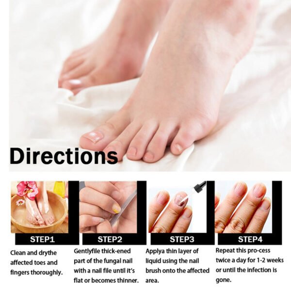 EELHOE Nail Repair Solution Thickening And Shining Nail Removal Dead Skin Repairing And Moisturizing Nail Nutritional Care Liquid - Image 3