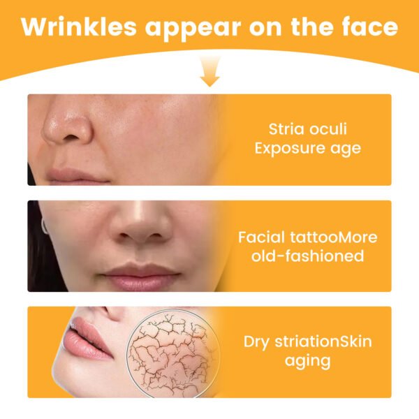 Lift The Facial Skin, Moisturize And Tighten The Wrinkles - Image 5