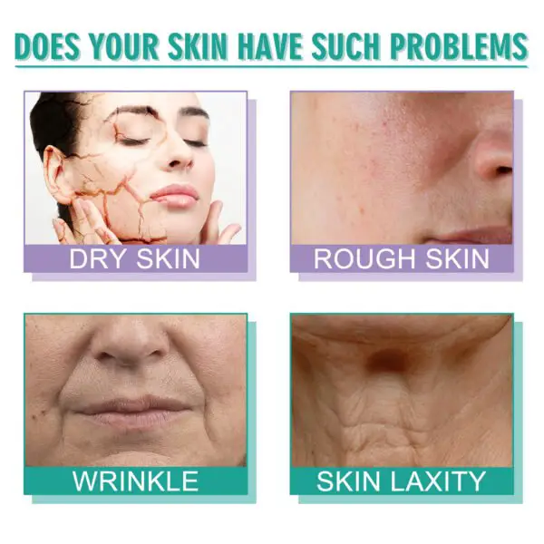 Hoygi Moisturizing Skin Care Cream Lighten Pigmentation Fine Lines Anti-Wrinkle Moisturizing Rejuvenation Whitening Firming Hydrating Cream - Image 2
