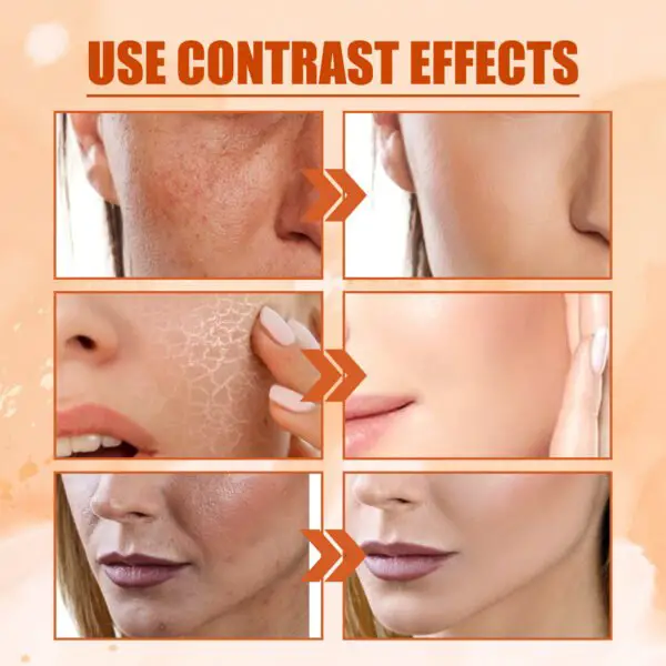 EELHOE Vitamin C Moisturizing Spray Moisturizing And Moisturizing Skin Lightening Acne Spots Rejuvenating And Whitening Spray - Image 8
