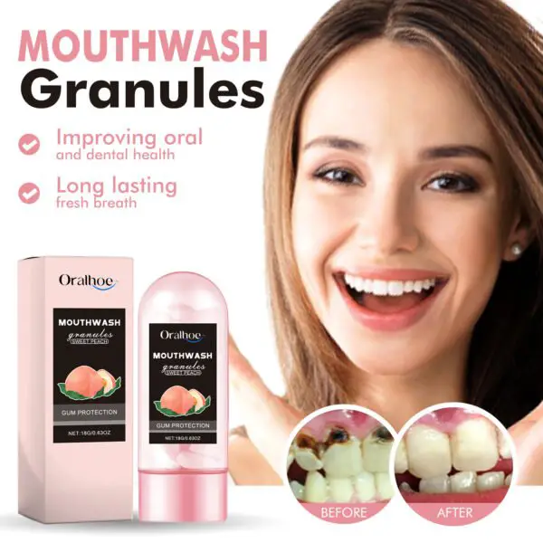Oralhoe Peach Flavor Teeth Cleaning Mouthwash Pellets Breath Long Lasting Fragrance Clean Gums Portable Mouthwash Pellets - Image 3