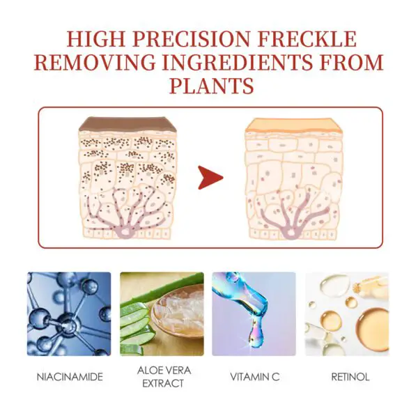 EELHOE Color Repair Cream Replenishes, Moisturizes, And Lightens Freckles, Black Spots, Blemishes, Melasma, And Melanin Skin Cream - Image 6