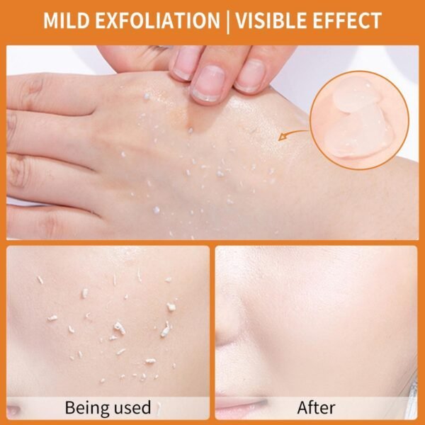 Exfoliating Gel-The Face Is Deeply Cleansed, Moisturized, And Gently Mud Exfoliates Dead Skin - Image 6