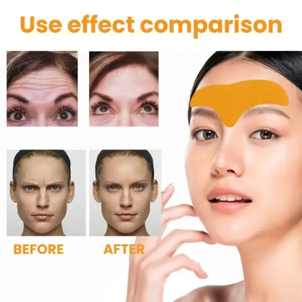 EELHOE Forehead Wrinkle Patch Lift And Smooth Forehead Wrinkles Facial Skin Forehead Patch - Image 9