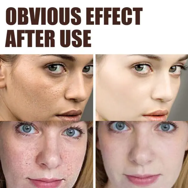 Retinol Anti Aging Wrinkle Removal Skin Firming Cream, EELHOE Retinol Cream Anti-Aging With Hyaluronic Acid And Vitamin - Image 4