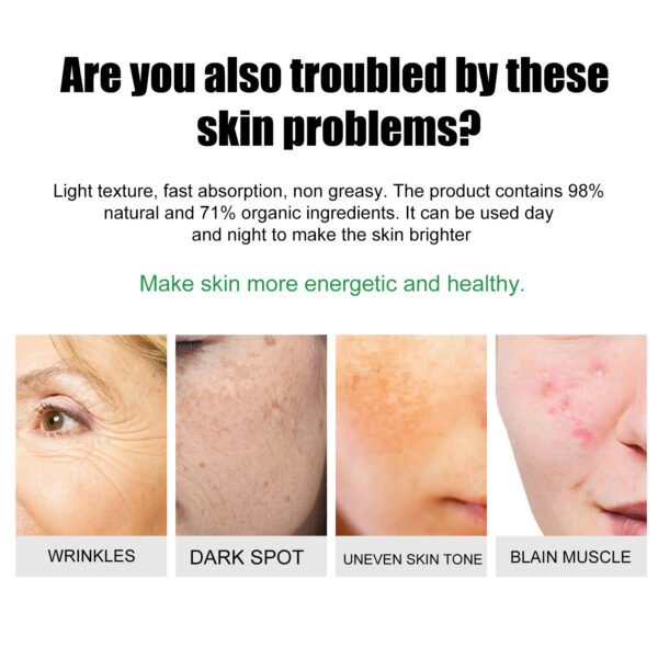 EELHOE Acne & Blemish Cream Lightens Blemishes & Acne Brightens Skin Complexion Moisturizing Skin Repair Cream - Image 5