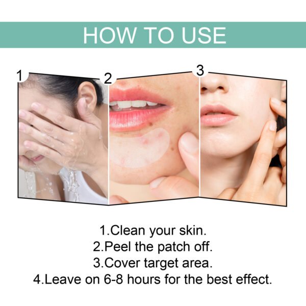 EELHOE Acne Relief Mask Patch Is A Gentle, Non-irritating Acne Mask That Helps To Reduce Acne Marks And Heal Acne. - Image 4