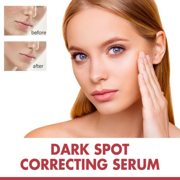 Hoygi Black Spot Repair Essence Lighten Skin Black Spot And Age Spot Moisturizing&Brightening Repair Essence - Image 5