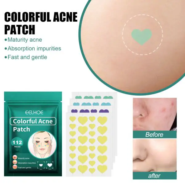 EELHOE Love Acne Patch Gentle Cleansing Acne Patch Fades Facial Acne Marks And Spots Facial Cleansing Care - Image 3